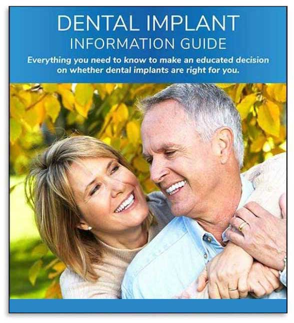 Dental Implant Guide