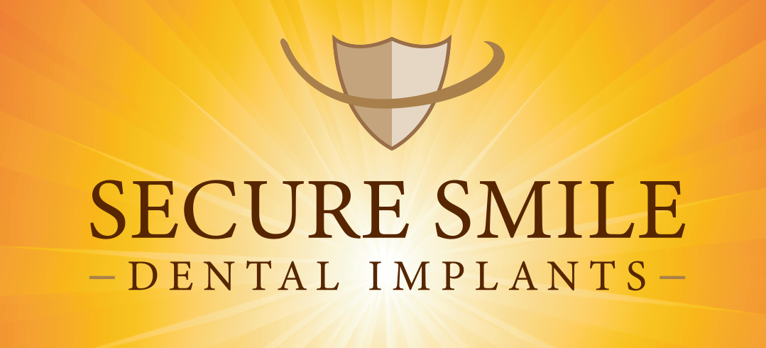 Secure Smile Dental Implants
